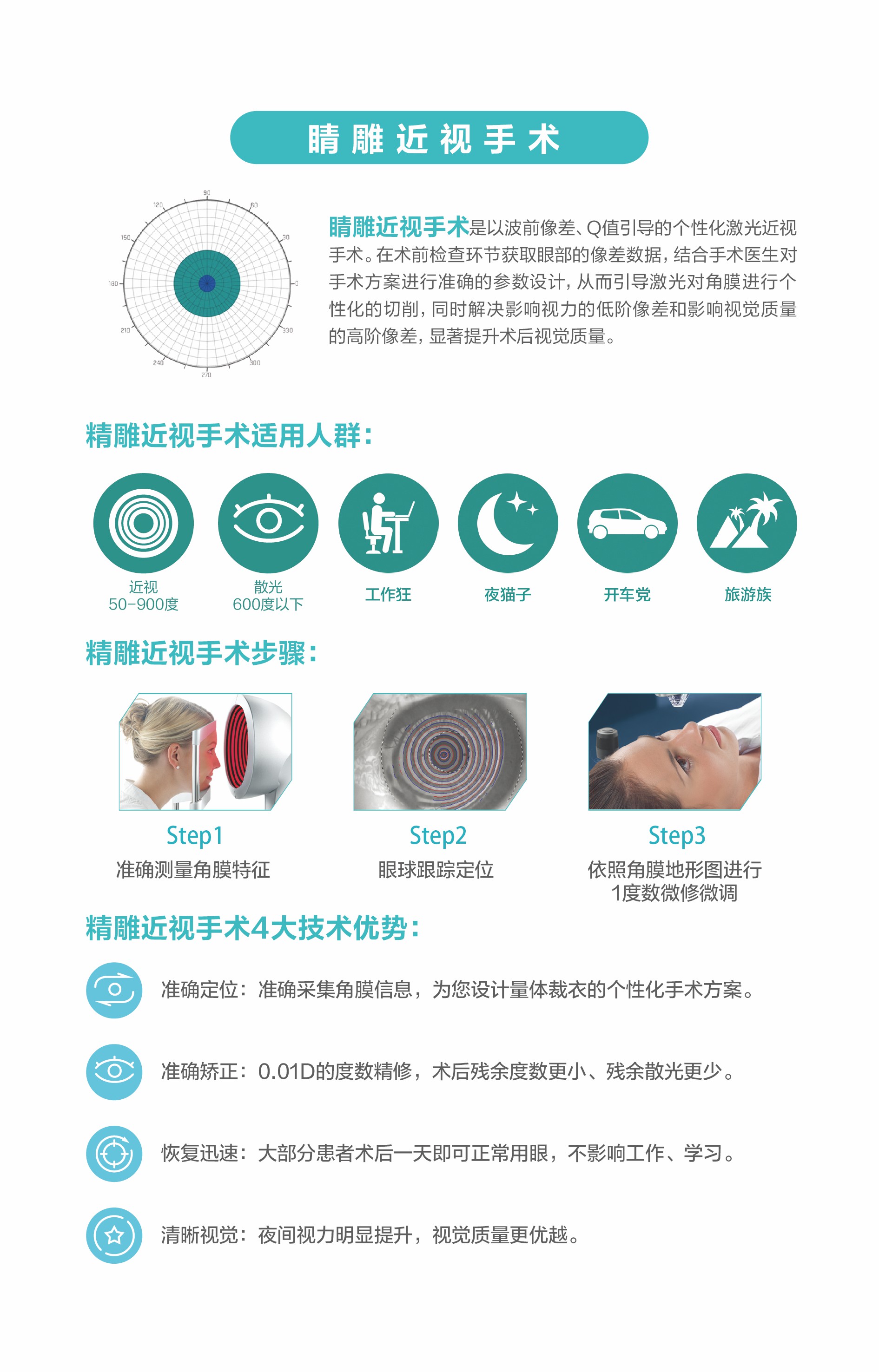 精雕近視手術 精雕近視手術
